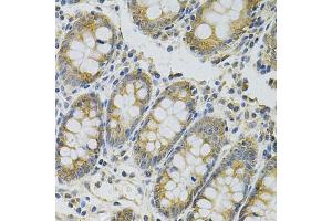 Immunohistochemistry of paraffin-embedded human colon using MYD88 Antibody (ABIN6290608) at dilution of 1:100 (40x lens). (MYD88 抗体)