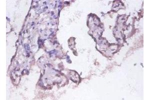 Immunohistochemistry (IHC) image for anti-Proteasome (Prosome, Macropain) 26S Subunit, Non-ATPase, 11 (PSMD11) (AA 2-422), (Regulatory Subunit 11) antibody (ABIN7142202)