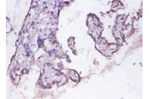 Immunohistochemistry of paraffin-embedded human placenta tissue using ABIN7142202 at dilution of 1:100 (PSMD11 抗体  (Regulatory Subunit 11))