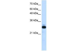 WB Suggested Anti-SAP30 Antibody Titration:  1. (SAP30 抗体  (Middle Region))