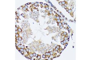 Immunohistochemistry of paraffin-embedded rat testis using γ-Tubulin Rabbit mAb (ABIN7271052) at dilution of 1:100 (40x lens). (TUBG1 抗体)