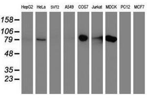 Image no. 2 for anti-Diacylglycerol Kinase, alpha 80kDa (DGKA) antibody (ABIN1497818) (DGKA 抗体)
