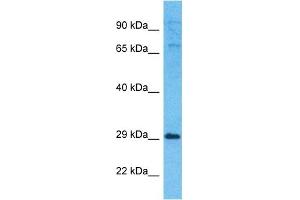 Host:  Rabbit  Target Name:  EXOS5  Sample Type:  721_B Whole Cell lysates  Antibody Dilution:  1. (EXOSC5 抗体  (N-Term))