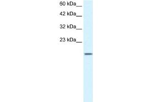 WB Suggested Anti-ZNF7 Antibody Titration:  1. (ZNF7 抗体  (N-Term))