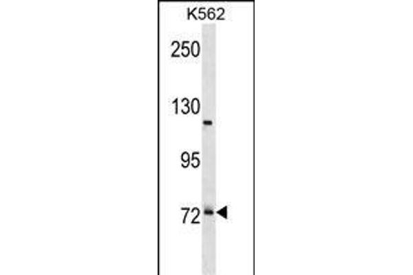PRPF39 抗体  (C-Term)