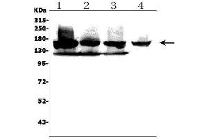 Western blot analysis of KDM6B using anti-KDM6B antibody (ABIN7599752).