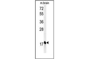 Western blot analysis of Complexin-1 Antibody (Center) in Mouse brain tissue lysates (35ug/lane). (Complexin 1 抗体  (Middle Region))