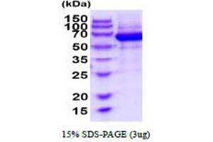 SDS-PAGE (SDS) image for EPH Receptor B4 (EPHB4) (AA 16-539) protein (His tag) (ABIN6387865)