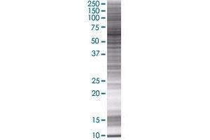 HSPD1 transfected lysate. (HSPD1 293T Cell Transient Overexpression Lysate(Denatured))