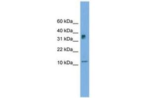 Image no. 1 for anti-Chromosome 15 Open Reading Frame 40 (C15orf40) (C-Term) antibody (ABIN6744994) (C15orf40 抗体  (C-Term))