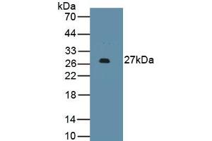 Detection of Recombinant PDCD1LG2, Human using Monoclonal Antibody to Programmed Cell Death Protein 1 Ligand 2 (PDL2) (PDCD1LG2 抗体  (AA 33-236))