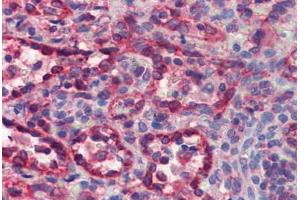 Human Spleen (formalin-fixed, paraffin-embedded) stained with CYCS antibody ABIN462359 followed by biotinylated anti-mouse IgG secondary antibody ABIN481714, alkaline phosphatase-streptavidin and chromogen. (Cytochrome C 抗体)