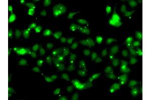 Immunofluorescence analysis of HeLa cell using CLK1 antibody. (CLK1 抗体)
