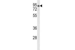 Western blot analysis of LDLR antibody and mouse lung tissue lysate. (LDLR 抗体  (AA 391-419))