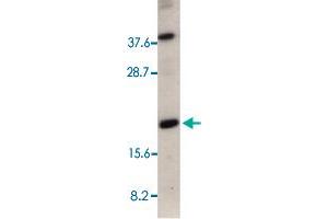 Western blot analysis of 50 ug of total cell lysate from HeLa cells with CRADD polyclonal antibody  at 1 : 500 dilution. (CRADD 抗体  (AA 181-199))