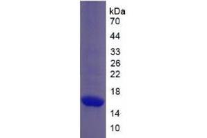 SDS-PAGE analysis of Monkey Collagen Type X Protein. (COL10 蛋白)
