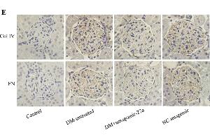 Immunohistochemistry (Paraffin-embedded Sections) (IHC (p)) image for anti-Collagen, Type IV (COL4) (AA 1571-1669) antibody (ABIN707396)