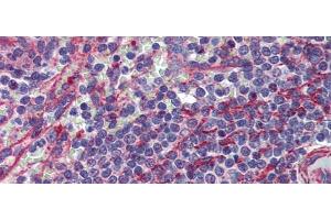 Rabbit Anti-MCTP1 Antibody  arp44441 Paraffin Embedded Tissue: Human Spleen Antibody Concentration: 5 ug/ml (MCTP1 抗体  (Middle Region))