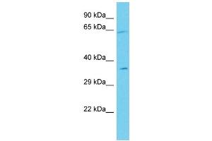 Host: Rabbit Target Name: ANKRD55 Sample Type: Jurkat Whole Cell lysates Antibody Dilution: 1. (ANKRD55 抗体  (C-Term))