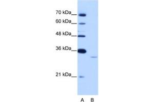Western Blotting (WB) image for anti-Exosome Component 6 (EXOSC6) antibody (ABIN2462323) (EXOSC6 抗体)