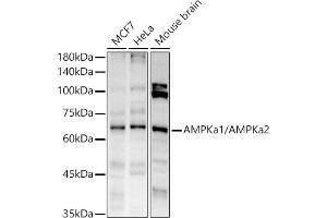 Western blot analysis of extracts of various cell lines, using AMPKa1/AMPKa2 antibody (ABIN6129902, ABIN6136848, ABIN6136849 and ABIN7101410) at 1:1000 dilution.