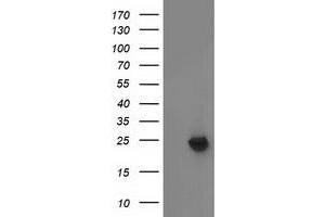 Western Blotting (WB) image for anti-Methylmalonic Aciduria (Cobalamin Deficiency) CblB Type (MMAB) antibody (ABIN1499509) (MMAB 抗体)