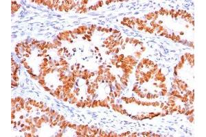 Image no. 1 for anti-Tumor Protein P53 (TP53) antibody (ABIN6164586)