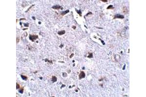 Immunohistochemical staining of mouse brain tissue with 2. (RCAN2 抗体  (Internal Region))