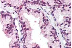 Human Prostate (formalin-fixed, paraffin-embedded) stained with DDX3X antibody ABIN337076 at 5 ug/ml followed by biotinylated goat anti-rabbit IgG secondary antibody ABIN481713, alkaline phosphatase-streptavidin and chromogen. (DDX3X 抗体  (N-Term))