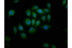 Immunofluorescence staining of A549 cells with ABIN7144872 at 1:166, counter-stained with DAPI. (ABCA12 抗体  (AA 45-158))