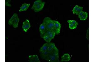 Immunofluorescence staining of HepG2 cells with ABIN7153389 at 1:75, counter-stained with DAPI. (Cyclin D2 抗体  (AA 1-289))