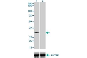 Western blot analysis of TLX3 over-expressed 293 cell line, cotransfected with TLX3 Validated Chimera RNAi (Lane 2) or non-transfected control (Lane 1). (TLX3 抗体  (AA 192-291))