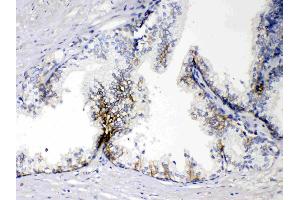 Immunohistochemistry (IHC) image for anti-Epithelial Cell Adhesion Molecule (EPCAM) (AA 147-189), (Middle Region) antibody (ABIN4886570)
