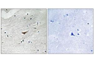Immunohistochemistry analysis of paraffin-embedded human brain tissue using VE-Cadherin (Phospho-Tyr731) antibody. (Cadherin 5 抗体  (pTyr731))