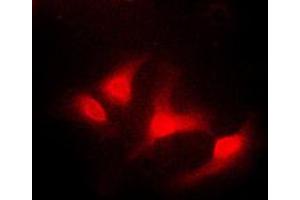Immunofluorescent analysis of ABL1 staining in K562 cells. (ABL1 抗体  (C-Term))