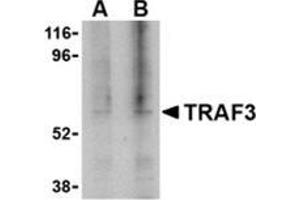Western blot analysis of TRAF3 in 3T3 cell lysate with this product at (A) 1, and (B) 2 μg/ml. (TRAF3 抗体  (C-Term))