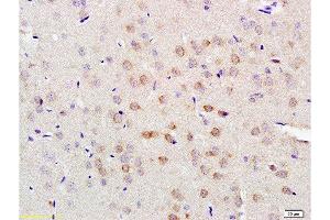 Formalin-fixed and paraffin embedded rat brain tissue labeled with Anti-LLGL1/2 Polyclonal Antibody, Unconjugated  at 1:200 followed by conjugation to the secondary antibody and DAB staining (LLGL1 抗体  (AA 801-900))