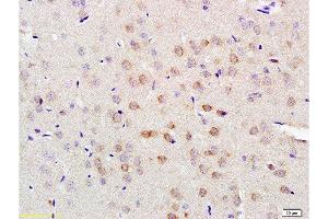 Formalin-fixed and paraffin embedded rat brain tissue labeled with Anti-LLGL1/2 Polyclonal Antibody, Unconjugated  at 1:200 followed by conjugation to the secondary antibody and DAB staining