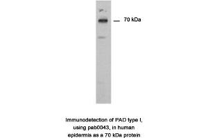 Image no. 1 for anti-Peptidyl Arginine Deiminase, Type I (PADI1) antibody (ABIN346990) (PADI1 抗体)