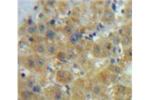 IHC-P analysis of Liver tissue, with DAB staining. (GDF10 抗体  (AA 339-477))