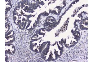 IHC analysis of RALBP1 using anti-RALBP1 antibody (ABIN5692936). (RALBP1 抗体  (AA 239-506))