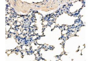 ABIN7094559 and ABIN7098608 at 1/100 staining Mouse lung tissue by IHC-P. (SMCHD1 抗体  (C-Term))