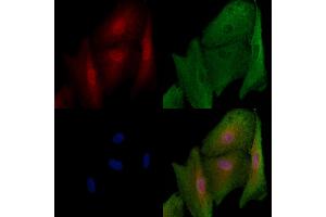 ABIN6257848 and ABIN6273703 staining  cells by IF/ICC. (KIF23 抗体  (Internal Region))