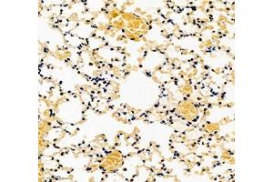 Immunohistochemistry (Paraffin-embedded Sections) (IHC (p)) image for anti-Collectin Sub-Family Member 12 (COLEC12) antibody (ABIN7073552)
