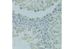 Immunohistochemistry of paraffin-embedded rat testis using CTAG1B antibody (ABIN6003542) at dilution of 1/100 (40x lens). (CTAG1B 抗体)