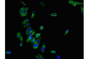 Immunofluorescent analysis of Hela cells using ABIN7145942 at dilution of 1:100 and Alexa Fluor 488-congugated AffiniPure Goat Anti-Rabbit IgG(H+L) (CCR7 抗体  (AA 332-378))
