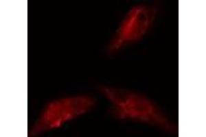 ABIN6278585 staining  293 cells by IF/ICC. (KIF20A 抗体  (C-Term))