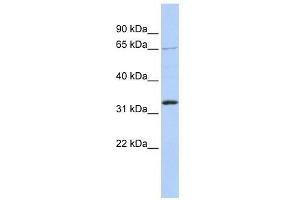 Western Blot showing GRHL2 antibody used at a concentration of 1.