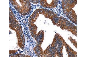 Immunohistochemistry (IHC) image for anti-Cullin 4A (CUL4A) antibody (ABIN1872121) (Cullin 4A 抗体)
