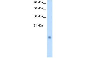 CSTB antibody - middle region  validated by WB using Transfected 293T cell lysate at 0. (CSTB 抗体  (Middle Region))